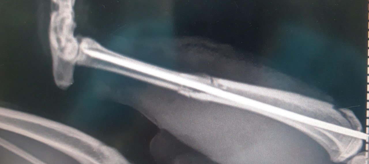 Radiographie d’un membre — examen d’imagerie réalisé à la clinique